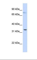 HepG2 cell lysate. Antibody concentration: 1.0 ug/ml. Gel concentration: 12%.