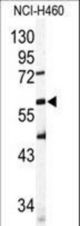 Western blot of SIGLEC6 Antibody in NCI-H460 cell line lysates (35 ug/lane). SIGLEC6 (arrow) was detected using the purified antibody.