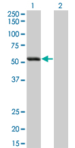 Western Blot analysis of SIGLEC6 expression in transfected 293T cell line by SIGLEC6 monoclonal antibody (M02), clone 2G6.Lane 1: SIGLEC6 transfected lysate(48.3 KDa).Lane 2: Non-transfected lysate.