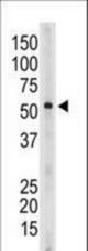 The anti-Siglec6 C-term antibody is used in Western blot to detect Siglec6 in mouse spleen tissue lysate.