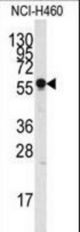 Western blot of anti-SIGLEC7 antibody in NCI-H460 cell line lysate (35 ug/lane). SIGLEC7(arrow) was detected using the purified antibody.