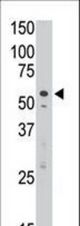 The anti-DSiglec C-term H422 antibody is used in Western blot to detect DSiglec in Jurkat cell lysate.