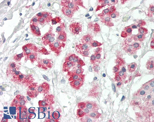 Human Adrenal: Formalin-Fixed, Paraffin-Embedded (FFPE)