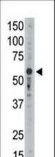 The anti-Siglec9 C-term antibody is used in Western blot to detect Siglec9 in mouse liver tissue lysate.