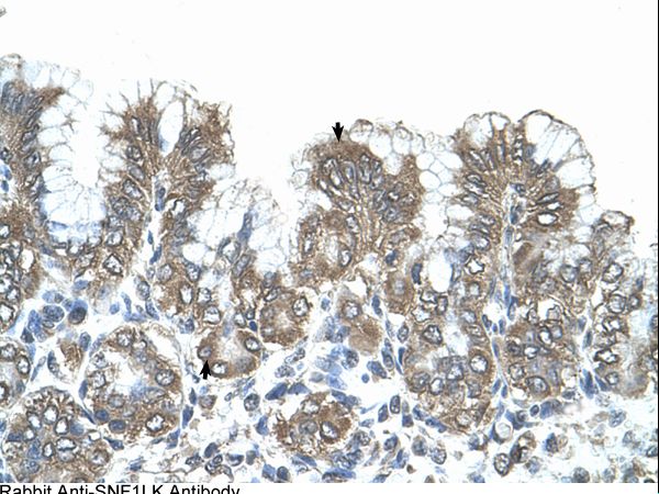 SIK1 / SNF1LK antibody LS-C80785 was used in IHC to stain formalin-fixed, paraffin-embedded human stomach.