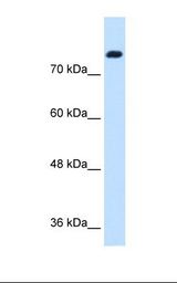 Jurkat cell lysate. Antibody concentration: 1.25 ug/ml. Gel concentration: 12%.
