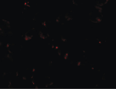 Immunofluorescence of SIK2 in SW480 cells with SIK2 antibody at 5 ug/ml.
