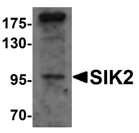 Western blot analysis of SIK2 in SW480 cell lysate with SIK2 antibody at 1 ug/ml.