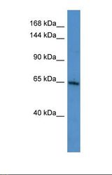 Western blot of Human MCF7 . SIK3 antibody dilution 1.0 ug/ml.