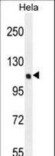 KIAA0999 Antibody western blot of HeLa cell line lysates (35 ug/lane). The KIAA0999 antibody detected the KIAA0999 protein (arrow).