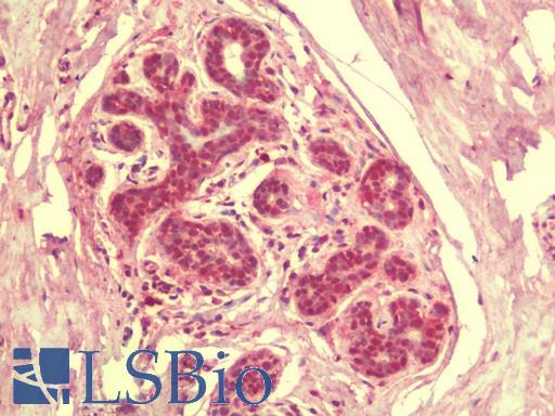 Anti-SIK3 / QSK antibody IHC staining of human breast. Immunohistochemistry of formalin-fixed, paraffin-embedded tissue after heat-induced antigen retrieval. Antibody LS-B9603 concentration 5 ug/ml.