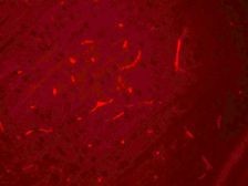Immunofluorescence of SIK3 in rat brain cells with SIK3 antibody at 20 µg/mL.