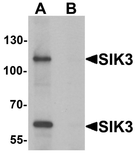 Western blot analysis of SIK3 in rat brain tissue lysate with SIK3 antibody at 1 ug/ml in (A) the absence and (B) the presence of blocking peptide.