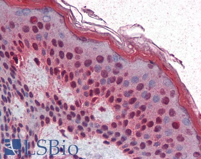 Anti-SIM1 antibody IHC of human skin. Immunohistochemistry of formalin-fixed, paraffin-embedded tissue after heat-induced antigen retrieval. Antibody LS-B3087 concentration 5 ug/ml.