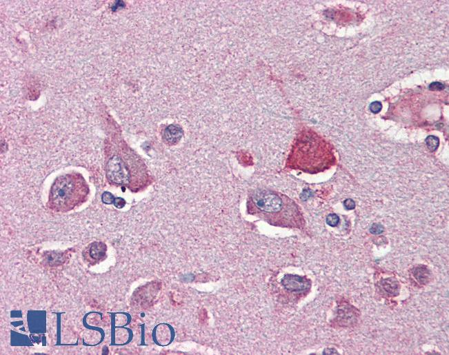 Anti-SIM1 antibody IHC of human brain, cortex. Immunohistochemistry of formalin-fixed, paraffin-embedded tissue after heat-induced antigen retrieval. Antibody LS-B3087 concentration 5 ug/ml.