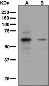 Western blot analysis on (A) fetal forebrain and (B) fetal brain lysate using anti-SIM2 antibody.