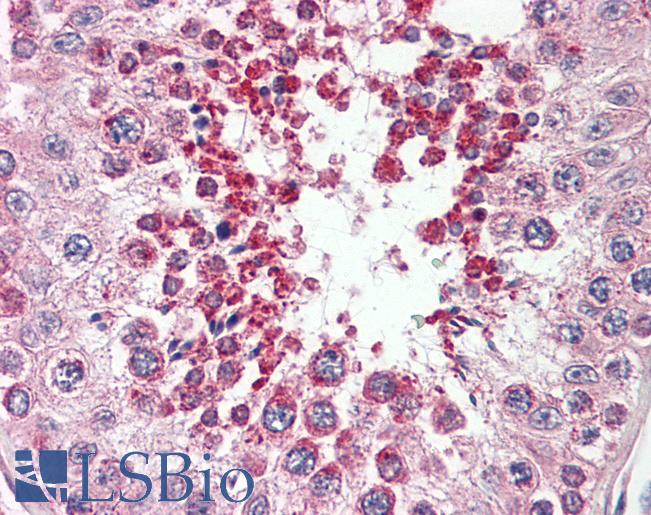 Anti-SIMPL / IRAK1BP1 antibody IHC staining of human testis. Immunohistochemistry of formalin-fixed, paraffin-embedded tissue after heat-induced antigen retrieval.