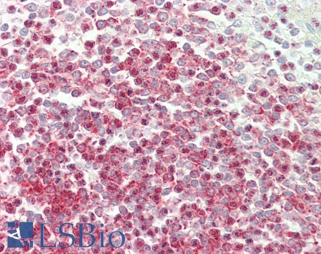 Human Spleen: Formalin-Fixed, Paraffin-Embedded (FFPE)