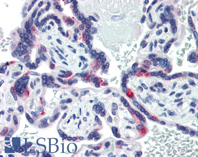 Anti-SIN3A antibody IHC of human placenta. Immunohistochemistry of formalin-fixed, paraffin-embedded tissue after heat-induced antigen retrieval. Antibody LS-B3492 concentration 5 ug/ml.