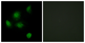 Immunofluorescence of HeLa cells, using SIN3B Antibody. The sample on the right was incubated with synthetic peptide.