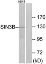 Western blot of extracts from A549 cells, using SIN3B Antibody. The lane on the right was incubated with synthetic peptide.