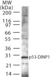 Western blot of p53DINP1 expression in mouse spleen using antibody at 1:5000 dilution.