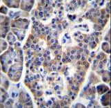 TP53INP1 Antibody immunohistochemistry of formalin-fixed and paraffin-embedded human pancreas tissue followed by peroxidase-conjugated secondary antibody and DAB staining.