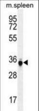 TP53INP1 Antibody western blot of mouse spleen tissue lysates (35 ug/lane). The TP53INP1 antibody detected the TP53INP1 protein (arrow).