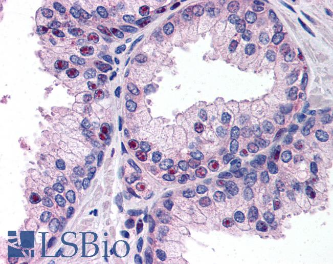 Anti-TP53INP1 antibody IHC of human prostate. Immunohistochemistry of formalin-fixed, paraffin-embedded tissue after heat-induced antigen retrieval. Antibody LS-B185 concentration 5 ug/ml.