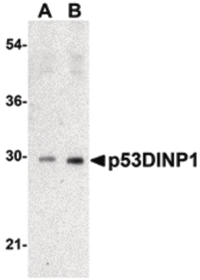 Western blot of p53DINP1 expression in human lung tissue lysate with p53DINP1 antibody at (A) 0.5 and (B) 1 ug/ml.
