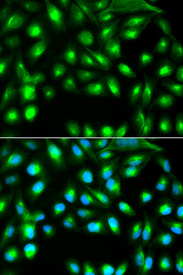 Immunofluorescence analysis of A549 cell using GEMIN2 antibody. Blue: DAPI for nuclear staining.