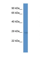 SIP1 antibody LS-C135096 Western blot of Mouse Brain lysate. Antibody concentration 1 ug/ml.
