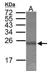 Anti-SIP1 antibody used in Western blot.