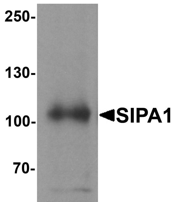 Western blot analysis of SIPA1 in human brain tissue lysate with SIPA1 antibody at 1 ug/ml.