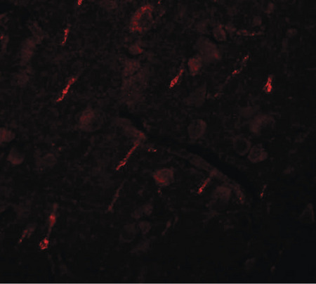 Immunofluorescence of SIPA1L2 in human brain tissue with SIPA1L2 antibody at 20 ug/ml.