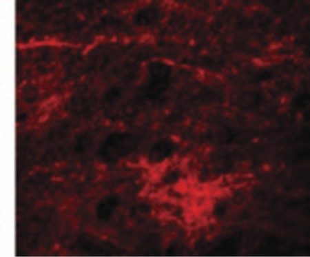 Immunofluorescence of SIPA1L3 in Human Brain cells with SIPA1L3 antibody at 20 ug/ml.