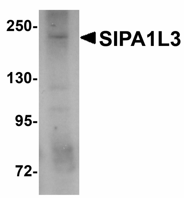 Western blot of SIPA1L3 in SK-N-SH lysate with SIPA1L3 antibody at 1 ug/ml.