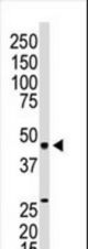 The anti-EDG3 N-term Antibody is used in Western blot to detect EDG3 in mouse kidney lysate.