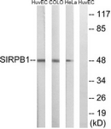 Western blot of extracts from HeLa/COLO/HUVEC cells, using SIRPB1 Antibody. The lane on the right is treated with the synthesized peptide.