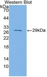 Western blot of recombinant SIRPB1 / CD172b.
