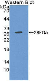 Western blot of recombinant SIRPB1 / CD172b.