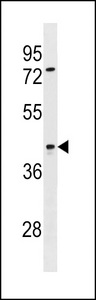 SIRPB2 Antibody western blot of ZR-75-1 cell line lysates (35 ug/lane). The SIRPB2 antibody detected the SIRPB2 protein (arrow).