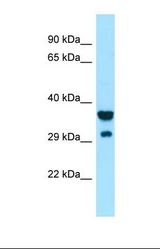 Western blot of Human ACHN. SIRPG antibody dilution 1.0 ug/ml.