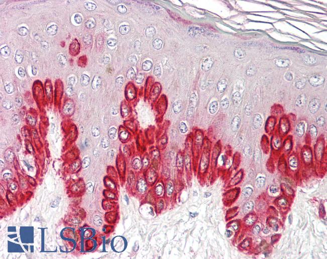 Anti-SIRT1 antibody IHC of human skin. Immunohistochemistry of formalin-fixed, paraffin-embedded tissue after heat-induced antigen retrieval. Antibody LS-B8356 dilution 3.75 ug/ml.