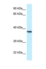 PSTPIP2 antibody LS-C145524 Western blot of Jurkat Cell lysate. Antibody concentration 1 ug/ml.