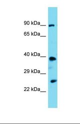 Western blot of Mouse Kidney. Pstpip2 antibody dilution 1.0 ug/ml.