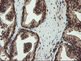 IHC of paraffin-embedded Human prostate tissue using anti-PROSC mouse monoclonal antibody.