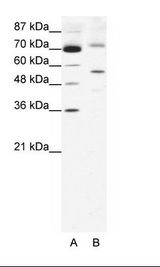 A: Marker, B: HepG2 Cell Lysate
