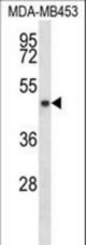 SIRT3 Antibody western blot of MDA-MB453 cell line lysates (35 ug/lane). The SIRT3 antibody detected the SIRT3 protein (arrow).