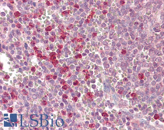 Anti-SIRT3 antibody IHC of human spleen. Immunohistochemistry of formalin-fixed, paraffin-embedded tissue after heat-induced antigen retrieval. Antibody LS-B8047 dilution 5-7.5 ug/ml.
